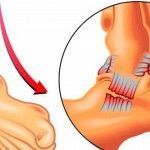 Cómo tratar una esguince desde casa