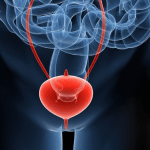 Depurar la vejiga de forma natural