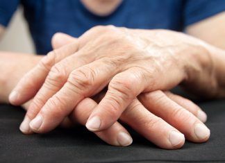 Tratamientos para aliviar la Artritis Los tratamientos naturales pueden ser muy efectivos