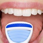 La saburra lingual y la importancia de conocer sus causas saburra lingual