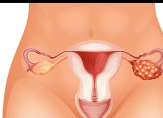 FXPOI o pérdida de la función normal de los ovarios