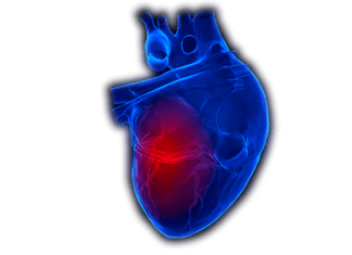 Insuficiencia cardiaca