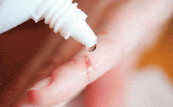 Los usos del agua oxigenada para la salud Agua oxigenada