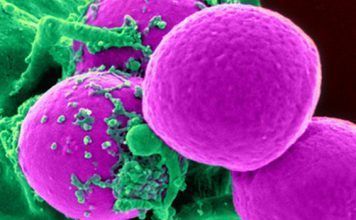 ¿Qué es el colesterol? – Términos importantes de nuestro organismo