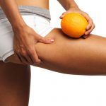 Afección de la celulitis, ¿por qué es tan común en las mujeres? afección de la celulitis