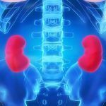 Lupus. Se puede reducir el daño renal haciendo ejercicios lupus y los daños en los riñones