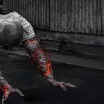 Las contracturas y los tipos de contracturas que existen – Parte 2