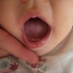 Efectiva lactancia materna reduce significativamente el riesgo de SMSL Efectiva lactancia materna