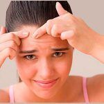 Molesto acné, esos molestos granitos que nos afean. Conozcámoslo Molesto acné