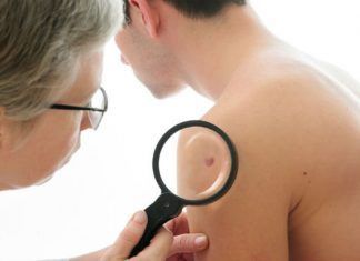 Desarrollo del cáncer de piel