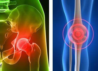 enfermedad de la osteoporosis