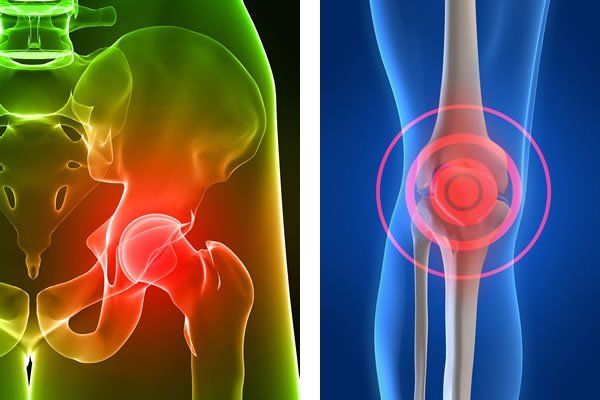 osteoporosis enfermedad de la osteoporosis