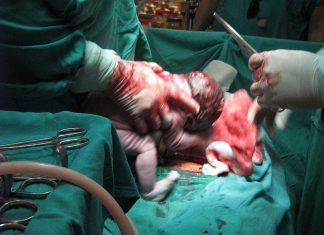 Tratamientos opcionales