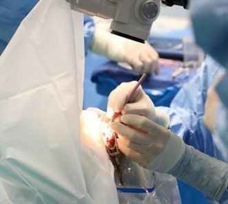 Cirugía para cataratas