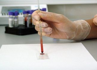 Anemia durante el embarazo