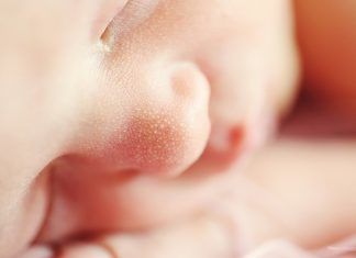 Anomalías genéticas