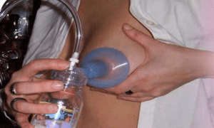 Muchas madres han donado leche materna