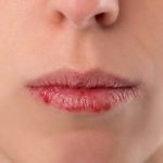 Consejos para aliviar la resequedad de los labios resequedad de los labios
