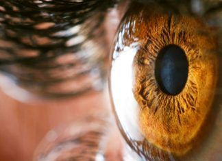 Queratitis Fúngica, infección de la córnea Queratitis Fúngica, infección de la córnea