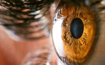 Queratitis Fúngica, infección de la córnea