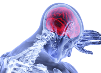 Ante un ataque cerebrovascular