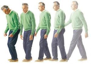 Enfermedad de Parkinson: Síntomas y Signos de alerta