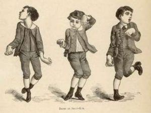 Conoce la Enfermedad de Hunghtinton