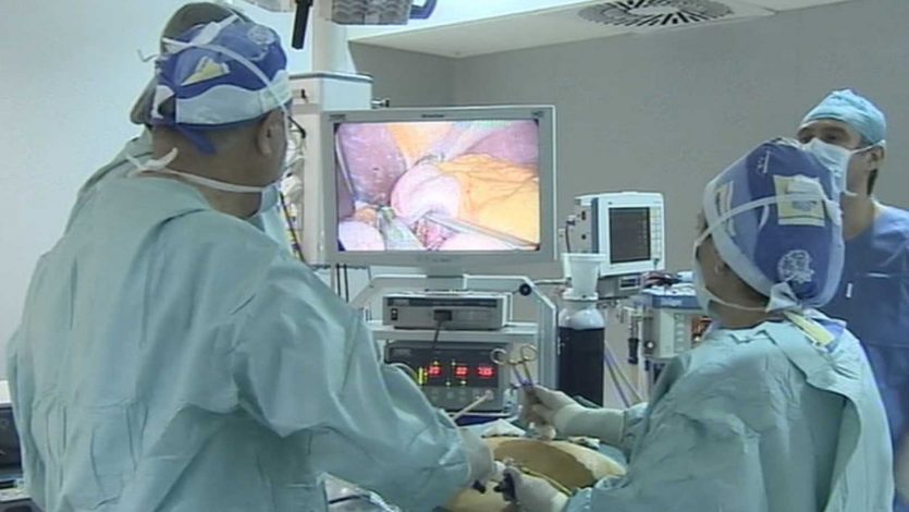 La ventaja de la laparoscopía: es que permite una visualización directa de los órganos