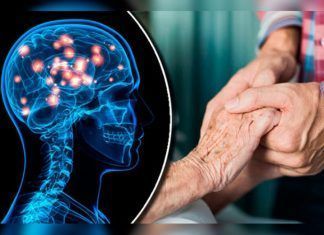 Conoce la Enfermedad de Hunghtinton