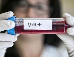 Eliminan el VIH de un Segundo Paciente