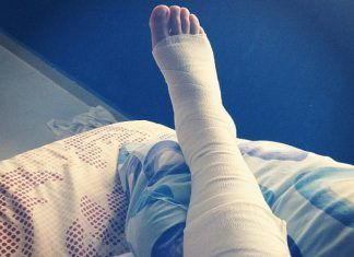 Torcedura o esguince: una diferencia que muchas veces nos confunde Torcedura o esguince