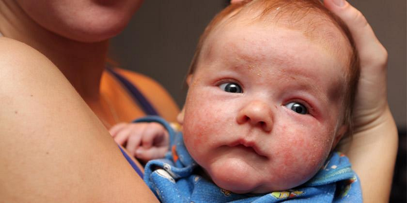 causas del sarpullido en bebes