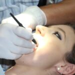 Blanqueamiento dental 1