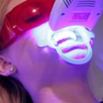 Blanqueamiento dental por led