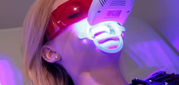 Blanqueamiento dental Led