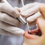 elegir un buen dentista