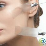 beneficios de la bichectomía