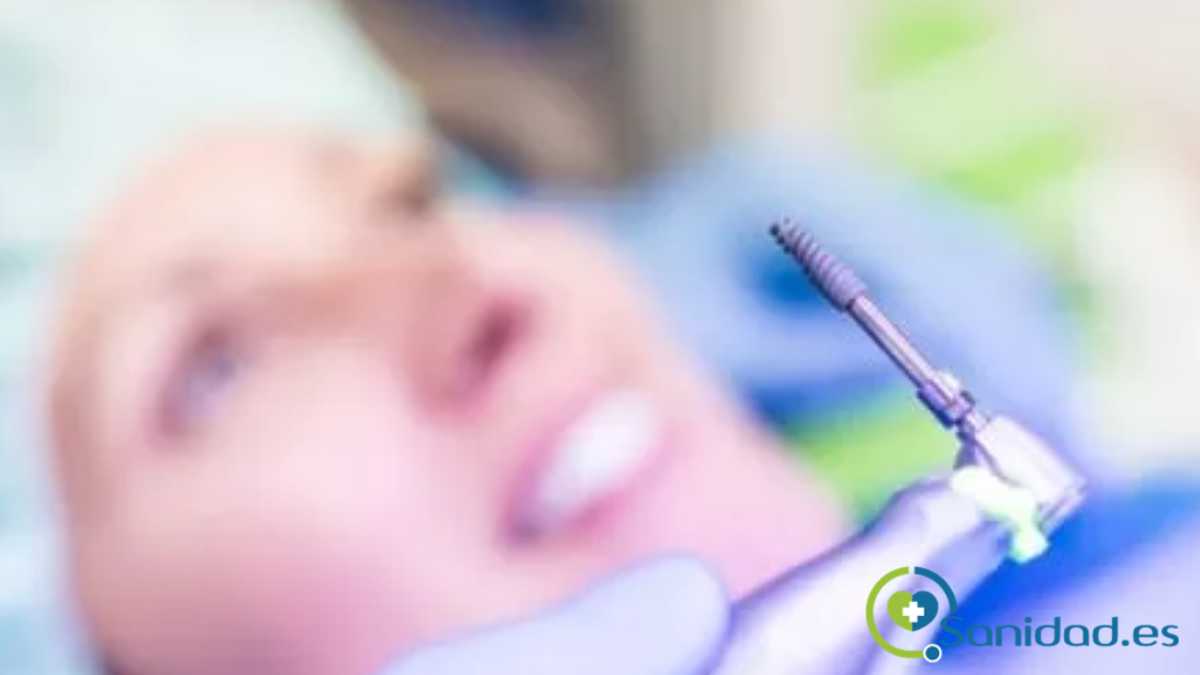 implantes dentales sin cirugía