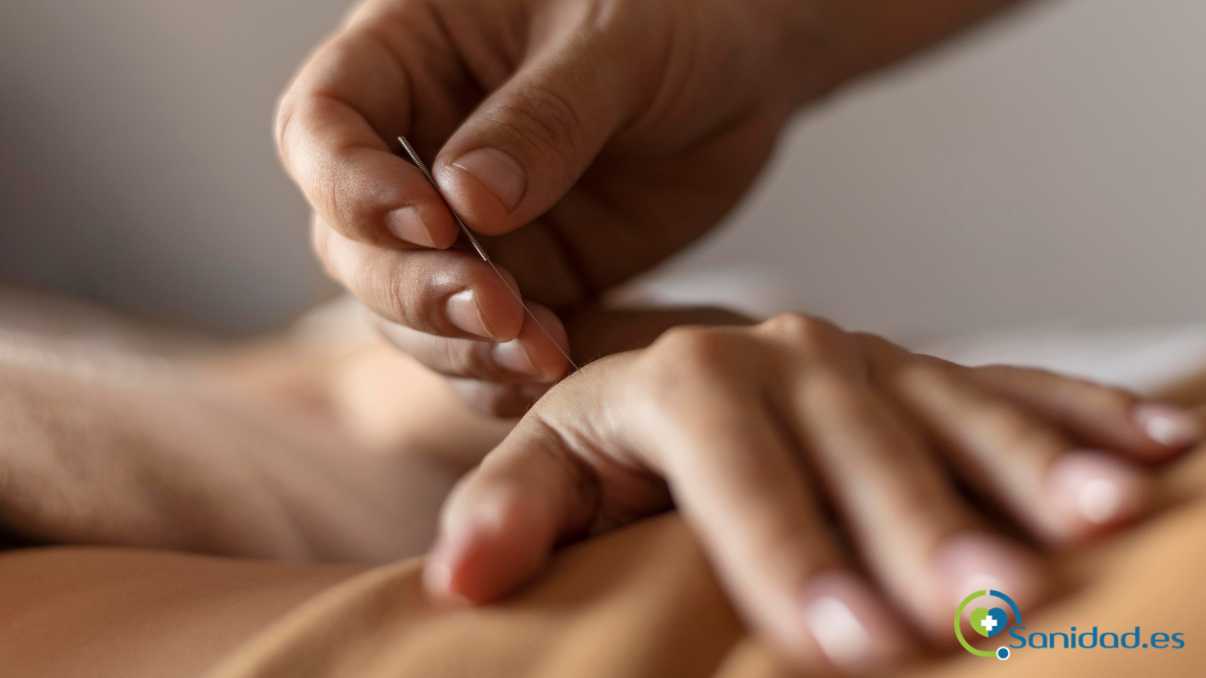 acupuntura para el dolor muscular