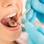Razones para ir al frecuentemente al odontólogo