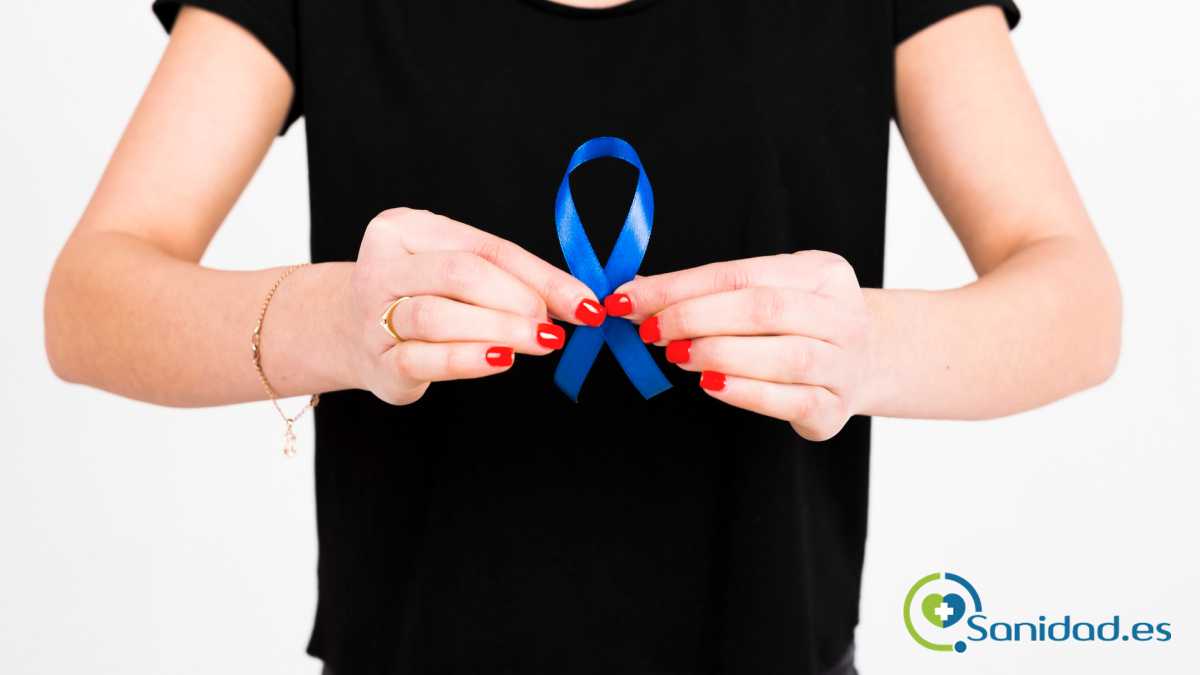 lo que debemos saber sobre el cáncer de colon