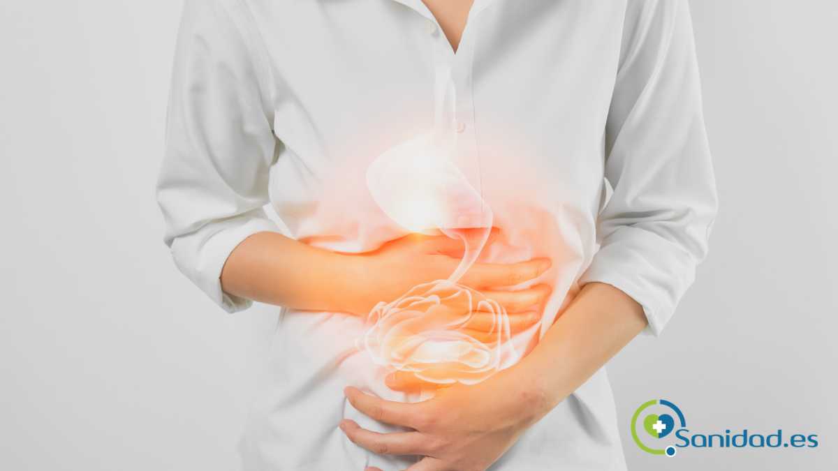 síntomas del cáncer de colon