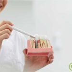 colocar una prótesis dental
