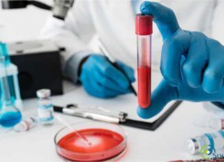 principales equipos de laboratorio clínico