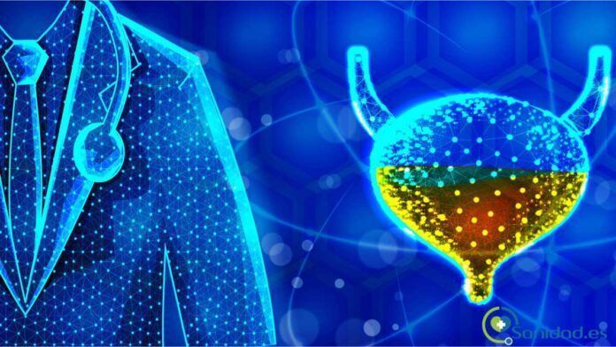 cáncer vesical cáncer vesical