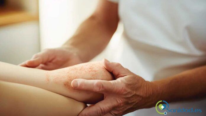 Beneficios de los tratamientos naturales sobre los farmacológicos