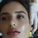 Combinar fotodepilación y fotorejuvenecimiento