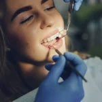 motivos para ir al ortodoncista