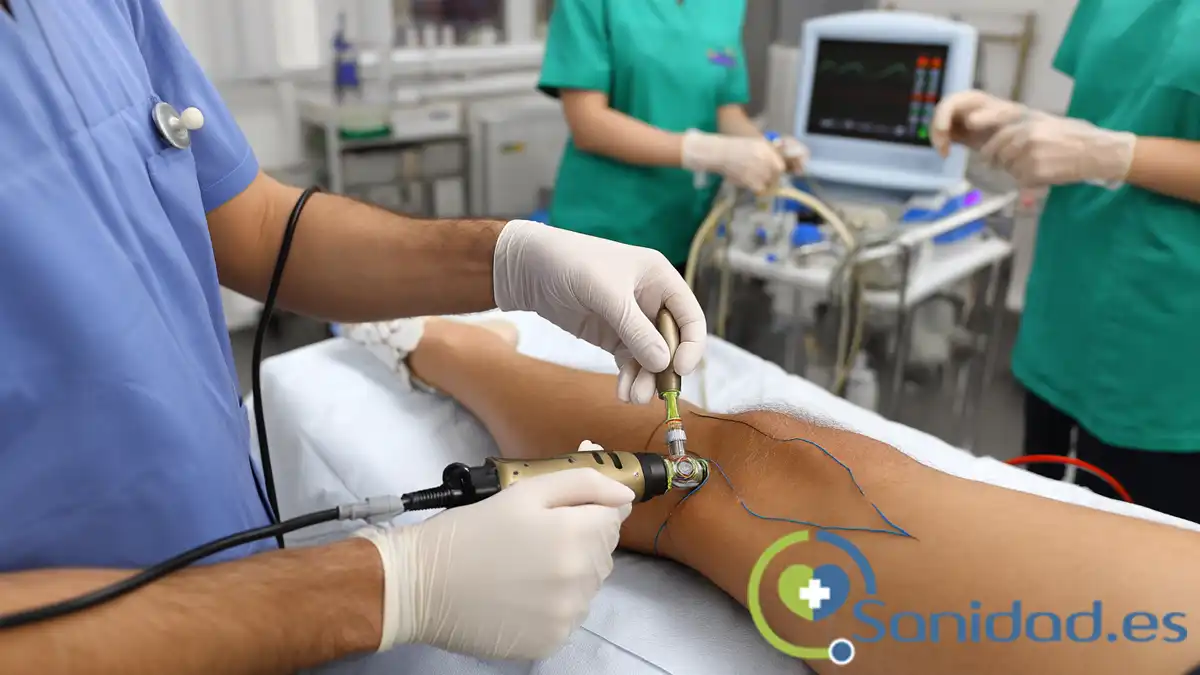 La ablación por radiofrecuencia es una técnica avanzada que cierra venas dañadas con calor controlado