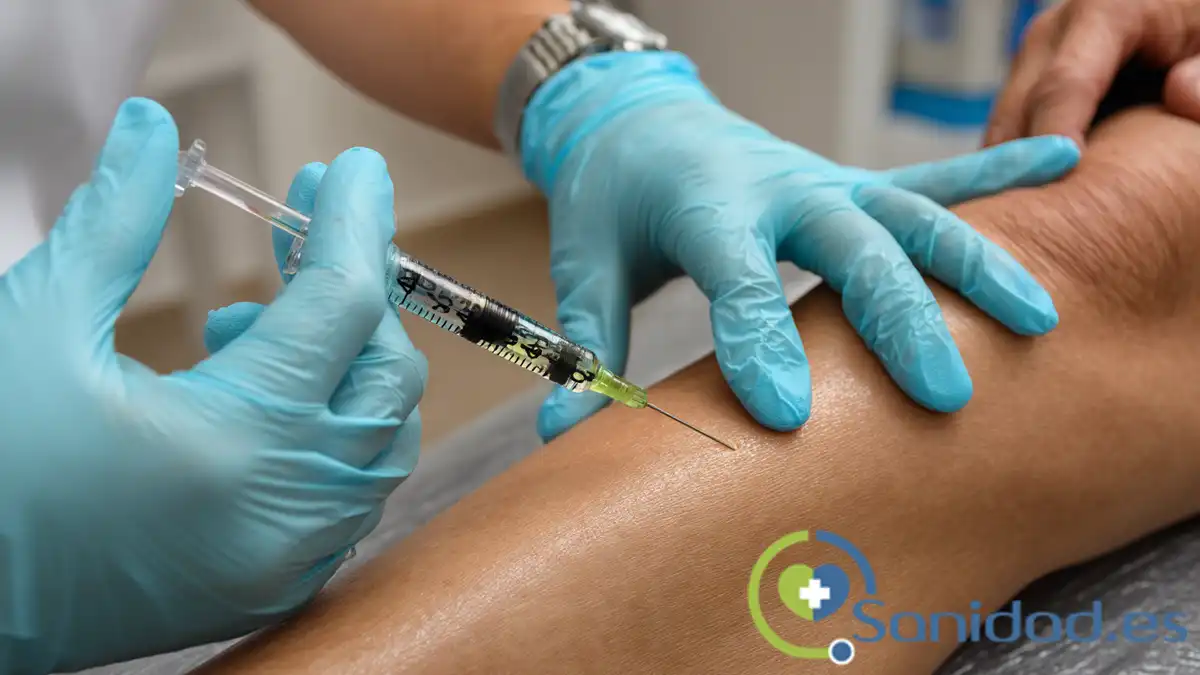 La escleroterapia es una técnica eficaz y poco invasiva para eliminar pequeñas y medianas várices.